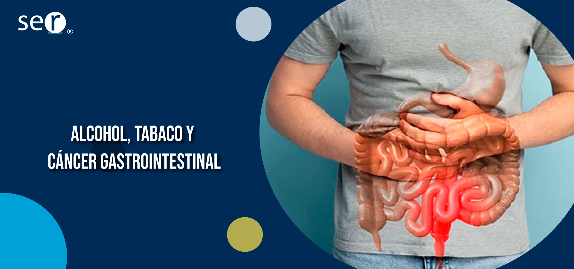 Clínica Ser - Alcohol, tabaco y cáncer gastrointestinal . Banner